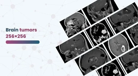 Brain tumors 256×256