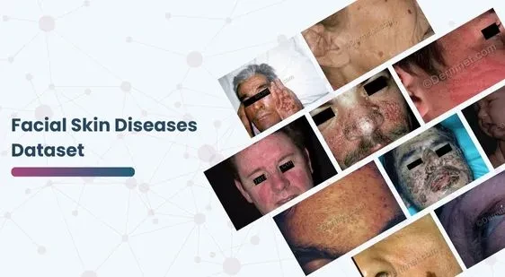 Facial Skin Diseases Dataset