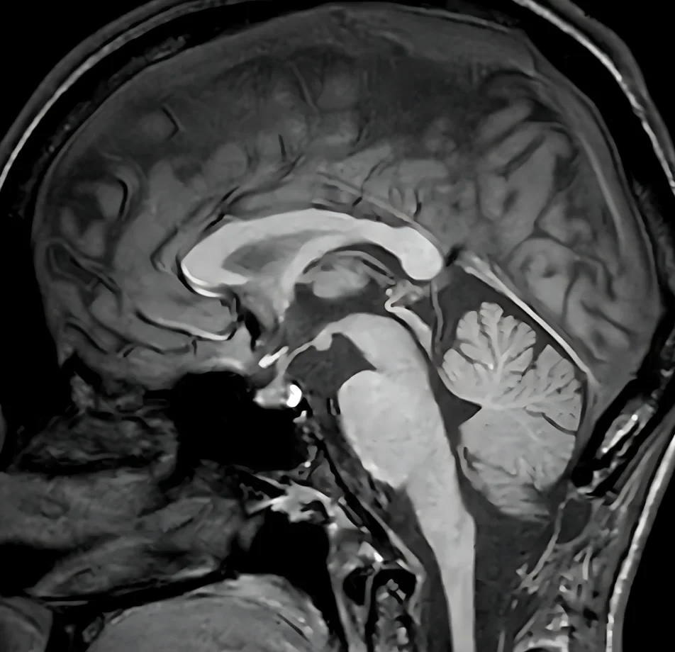 Medical Data Collection