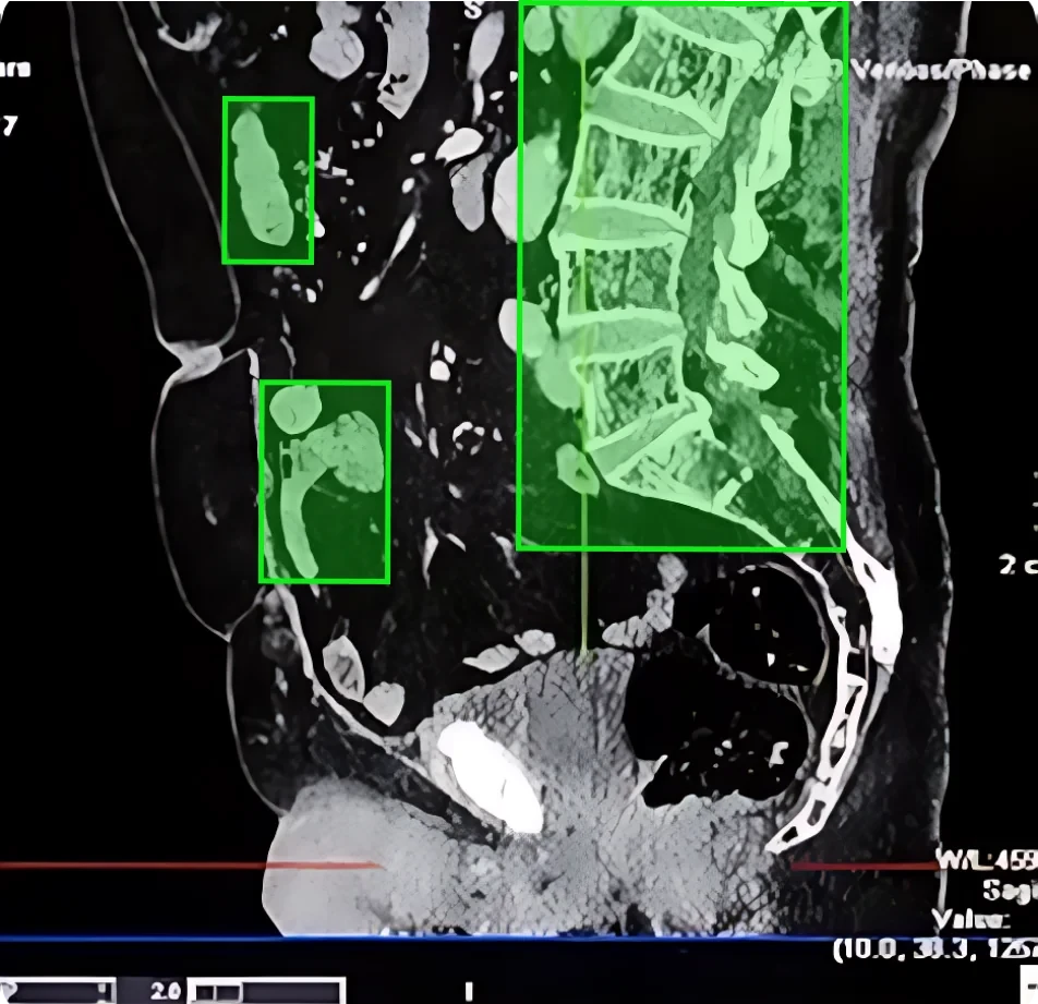 Medical Data Collection
