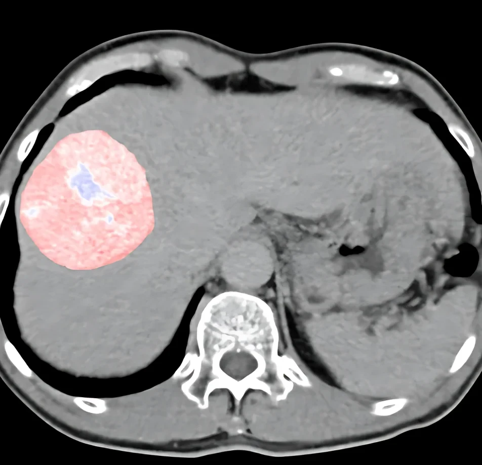 Medical Data Collection