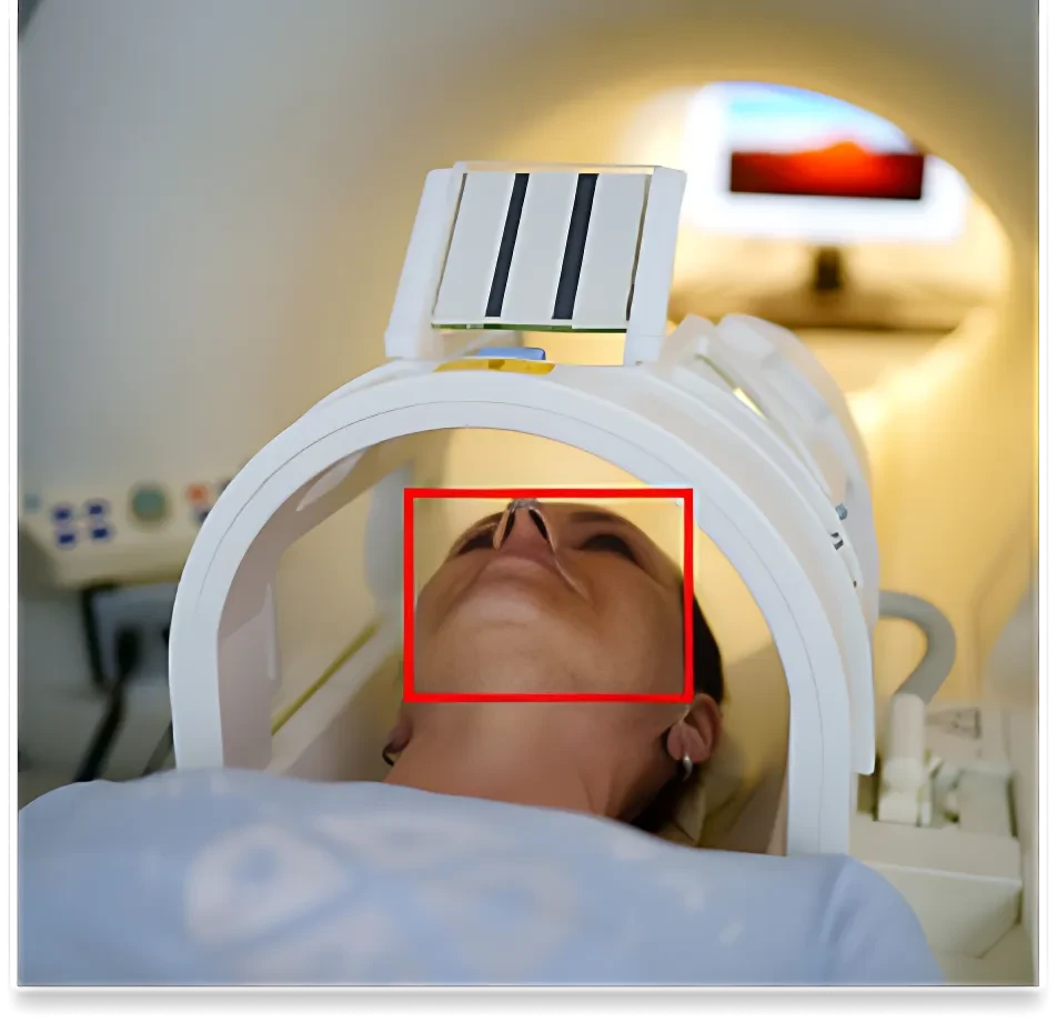 MRI Scan Image Dataset