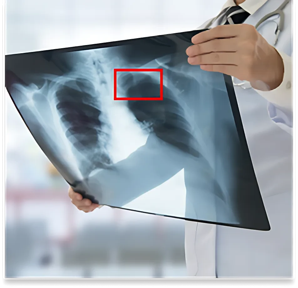 X-Ray Image Dataset