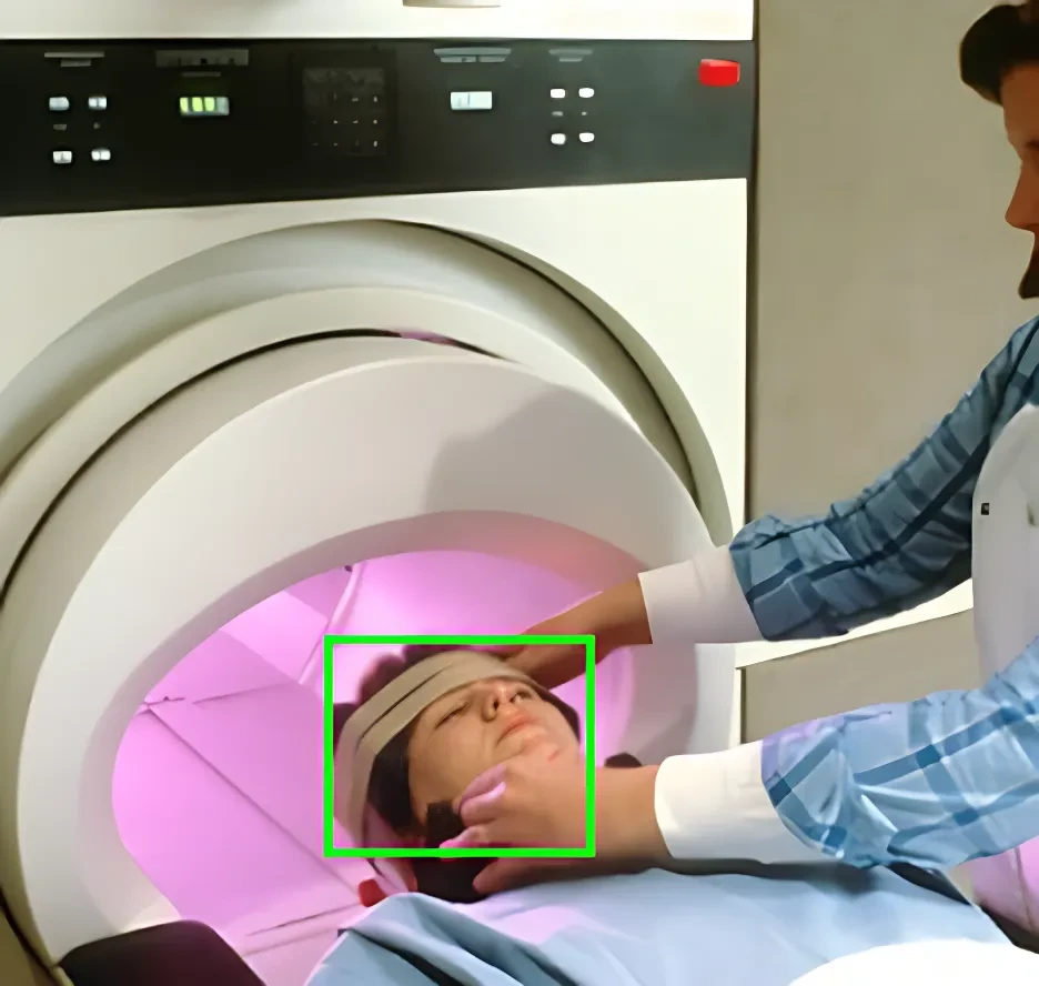 MRI Scan Image Dataset