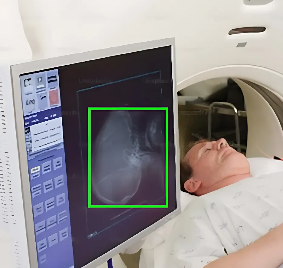 CT Scan Image Dataset
