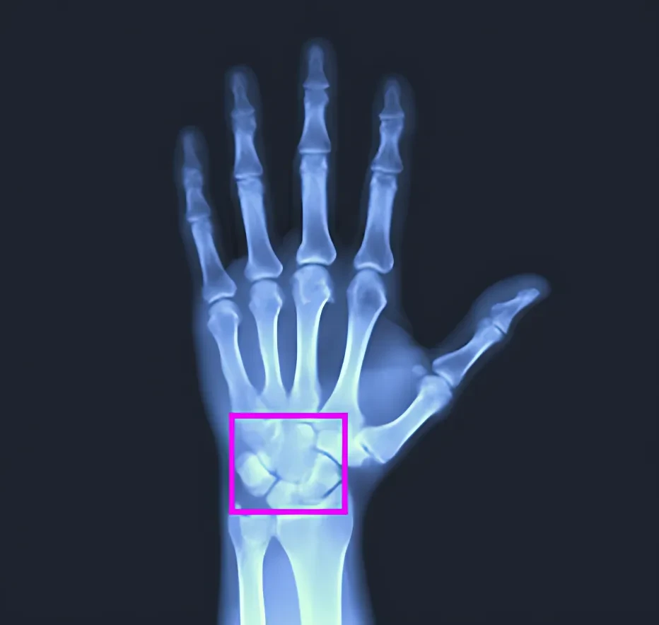 X-Ray Image Dataset