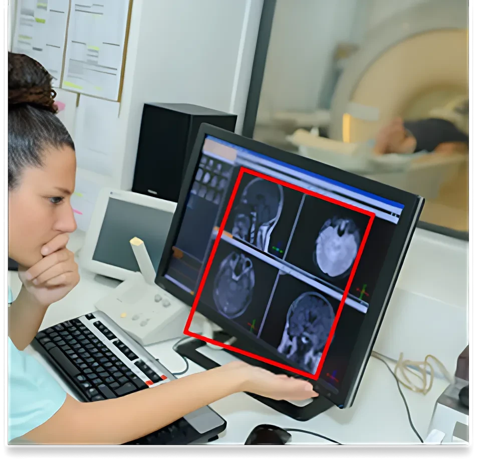 MRI Scan Image Dataset