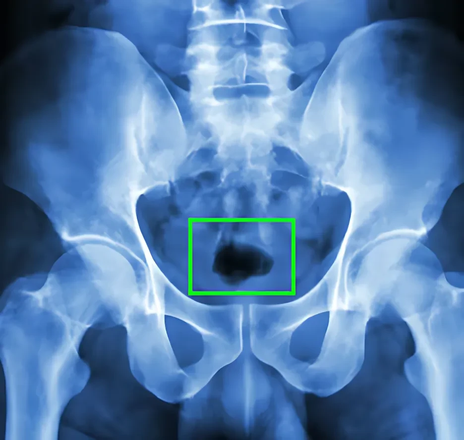 X-Ray Image Dataset