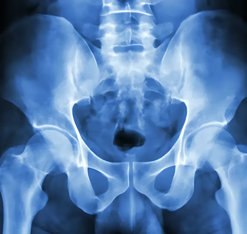X-Ray Image Dataset