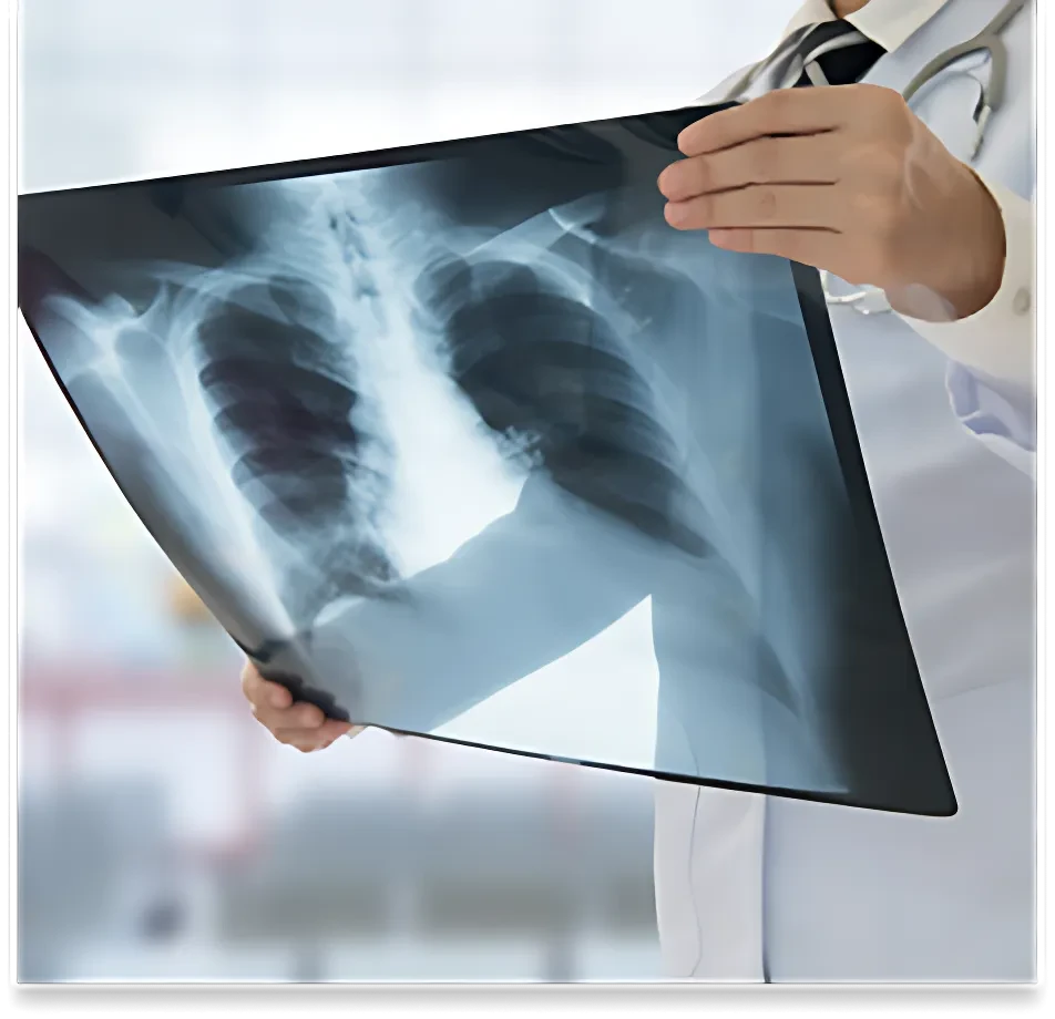 X-Ray Image Dataset