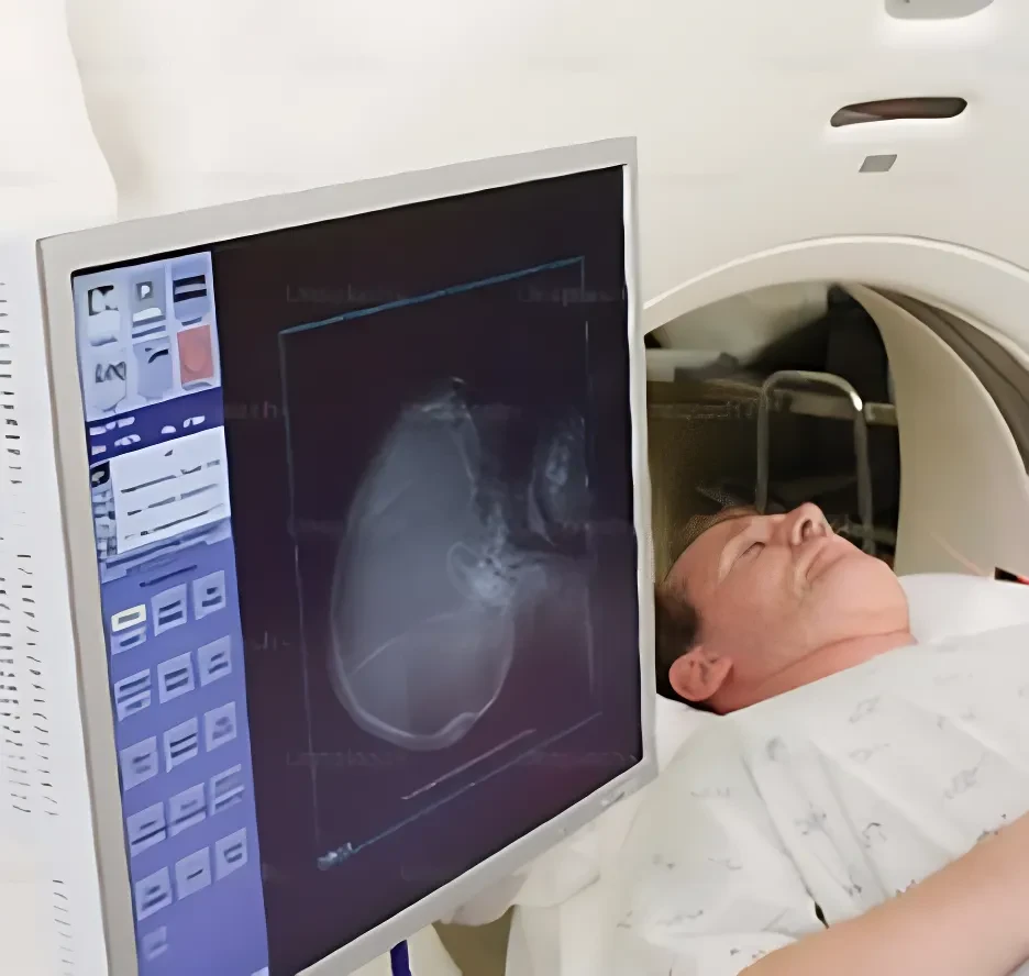 CT Scan Image Dataset