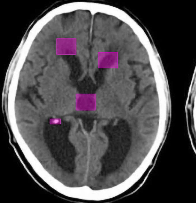 Clinical Dataset