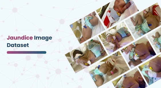 Jaundice Image Dataset