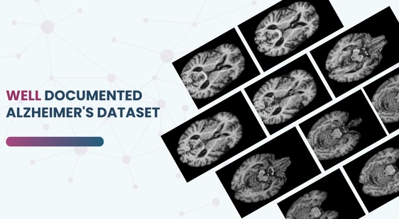 well-documented Alzheimer's dataset
