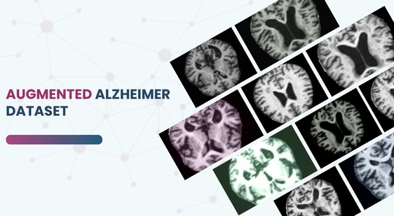 Augmented Alzheimer MRI Dataset