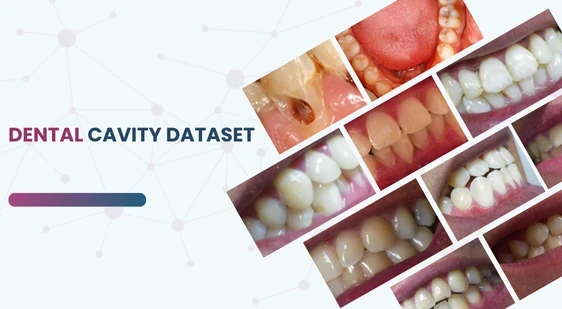 Dental Cavity Detection Dataset