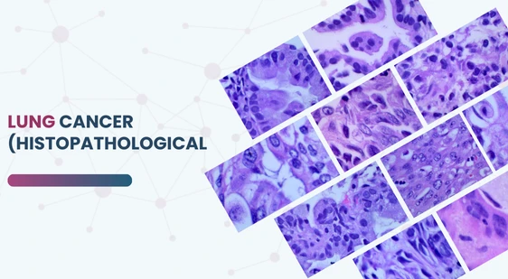 Lung Cancer (Histopathological Images)