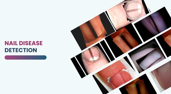 Nail Disease Detection