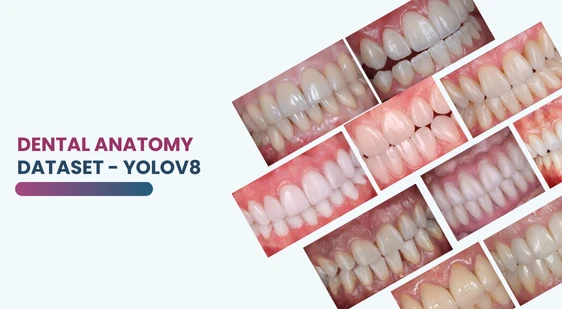 Dental Anatomy Dataset - Yolov8