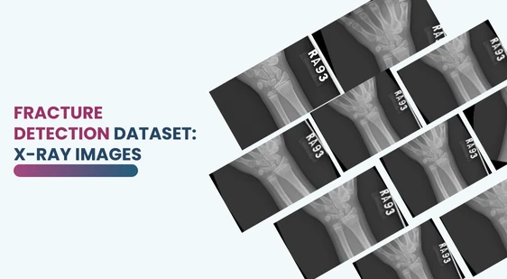 Fracture Detection Dataset: X-Ray Images
