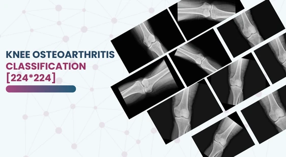 knee osteoporosis X-ray dataset