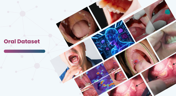 Oral Dataset